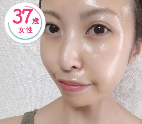 37歳女性