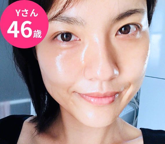 Yさん 46歳